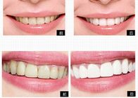 Système privé de blanchiment de dent de produits de soin personnel de logo pour les dents à la maison blanchissant